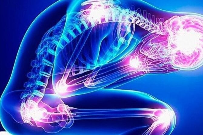 What is Fibromyalgia?